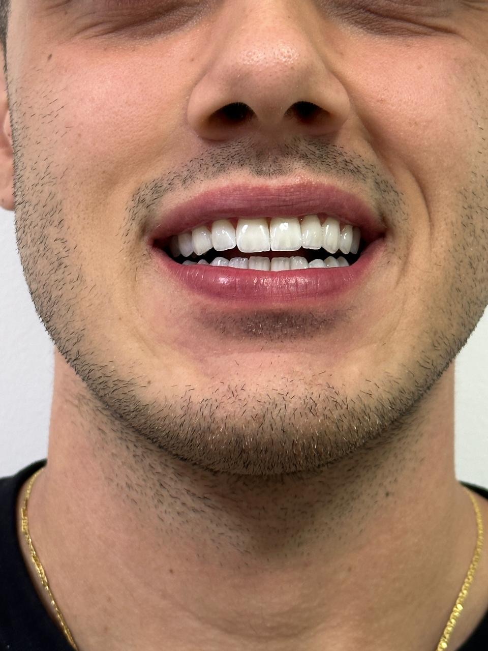 Estética do Sorriso — Naturalidade absoluta