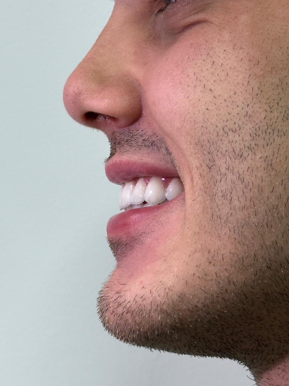 Perfil Estético — Equilíbrio facial